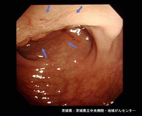 画像ID:4274