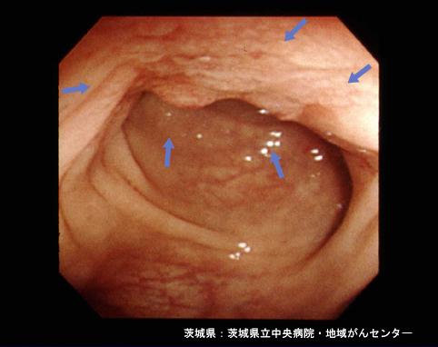 画像ID:4275