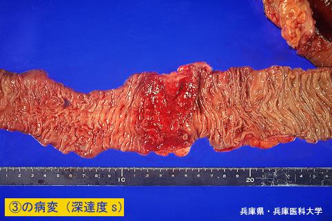 画像ID:4294