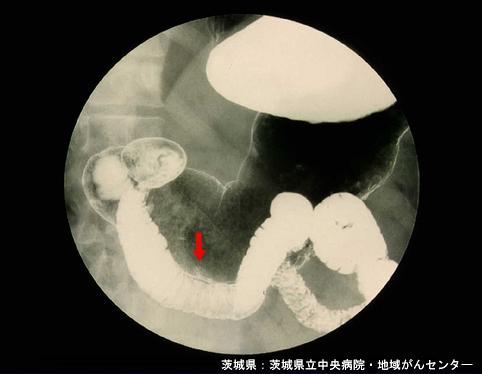 画像ID:4303