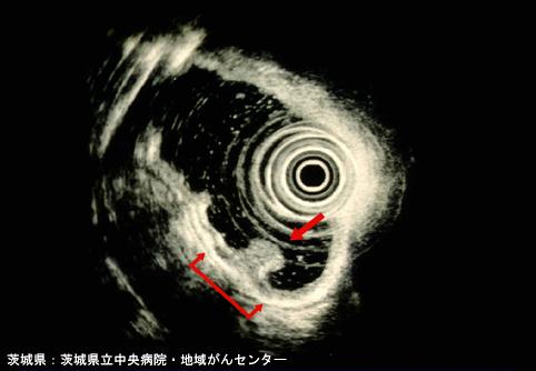 画像ID:4311