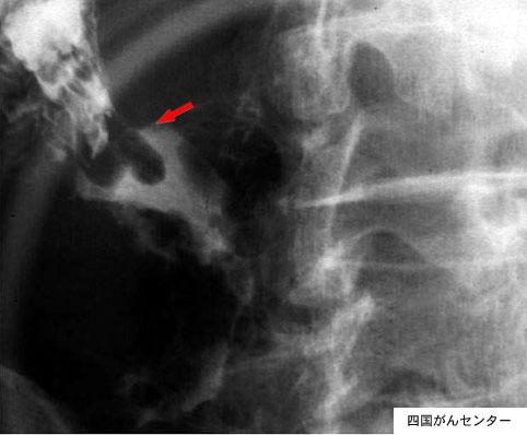 画像ID:4345