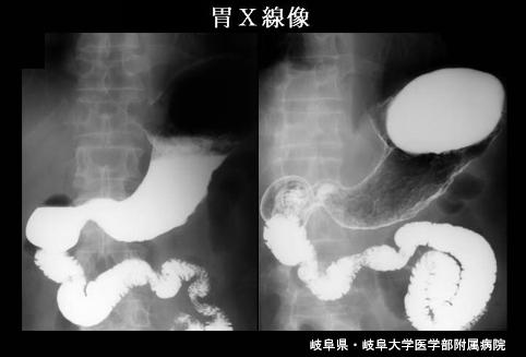 画像ID:4364