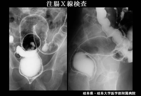 画像ID:4365