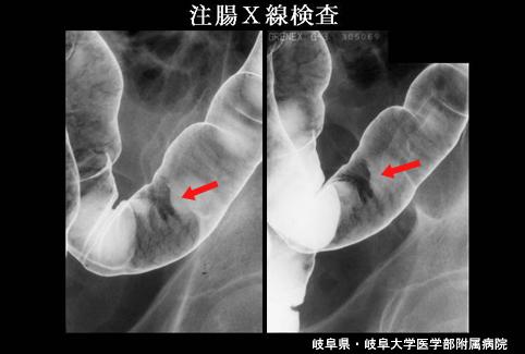 画像ID:4367