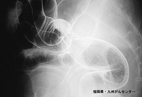 画像ID:4394