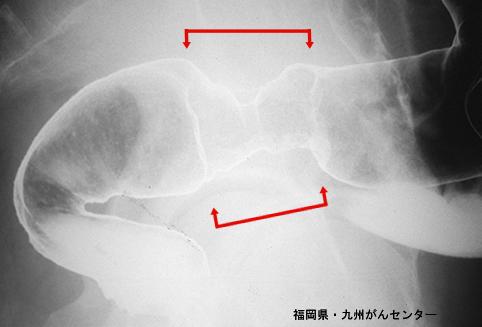 画像ID:4396