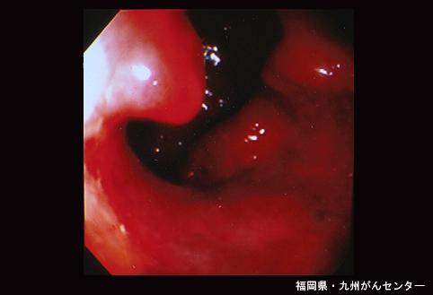 画像ID:4401