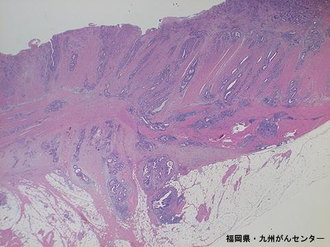 画像ID:4409