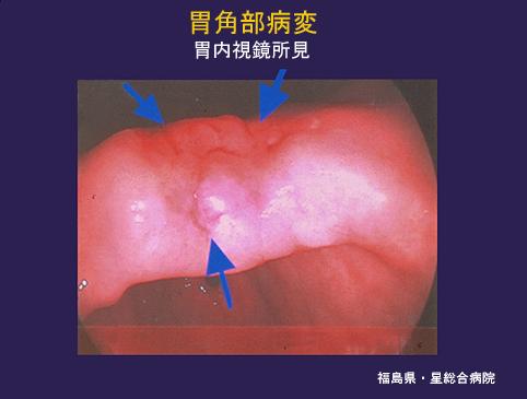 画像ID:4453