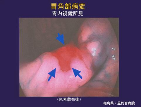 画像ID:4454