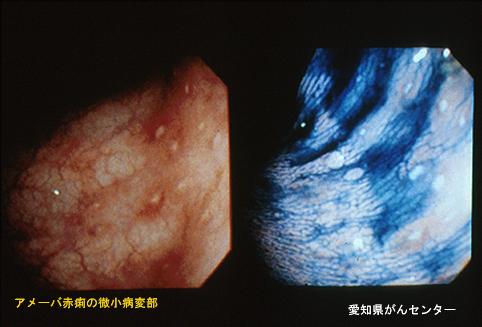 画像ID:4522