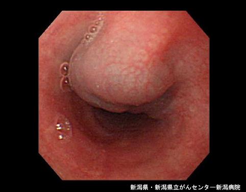 画像ID:4543