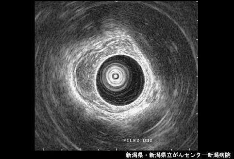 画像ID:4544