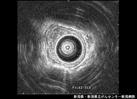 画像ID:4545