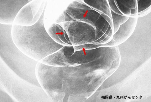 画像ID:4555