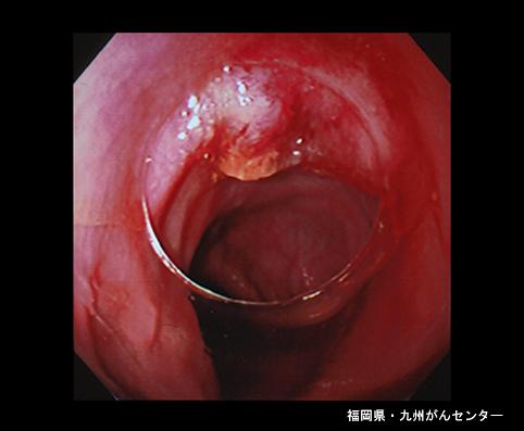 画像ID:4558