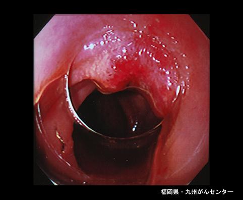 画像ID:4560
