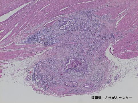 画像ID:4571