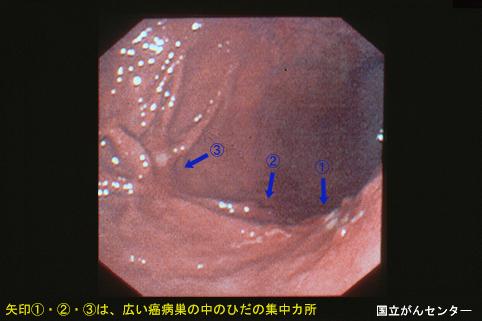 画像ID:4577