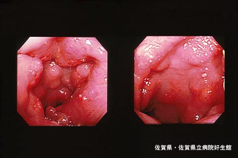 画像ID:4598