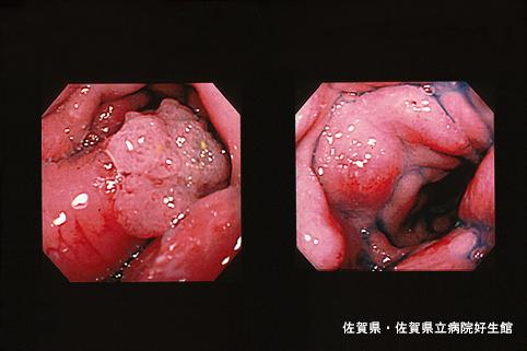 画像ID:4601