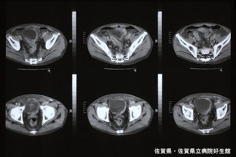 画像ID:4602