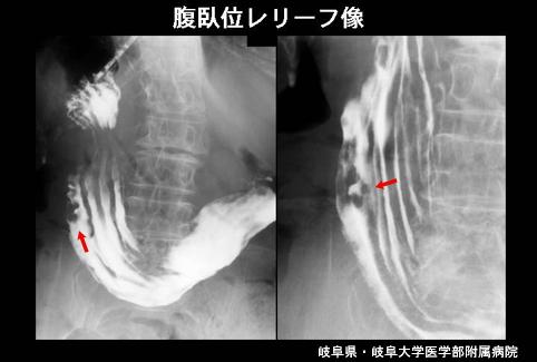 画像ID:4614