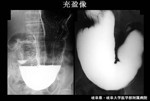 画像ID:4623