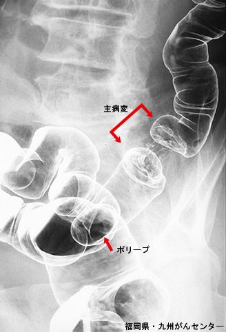 画像ID:4638
