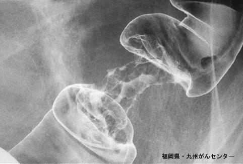 画像ID:4642