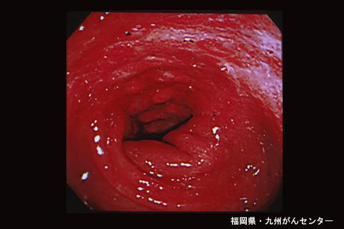 画像ID:4644