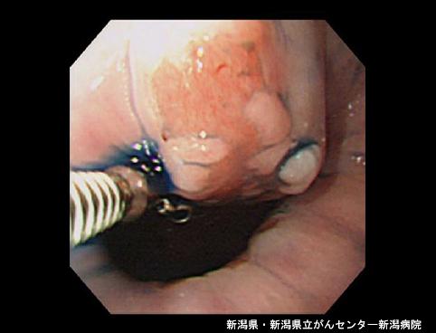 画像ID:4668