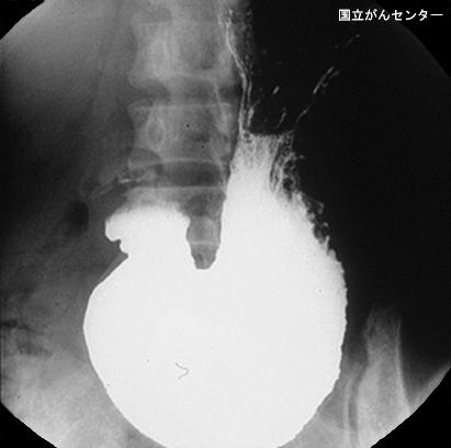画像ID:4679