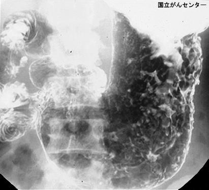 画像ID:4681