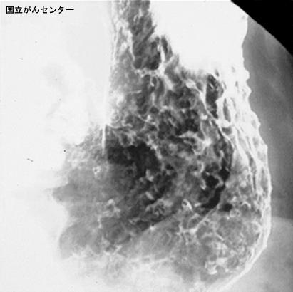 画像ID:4682