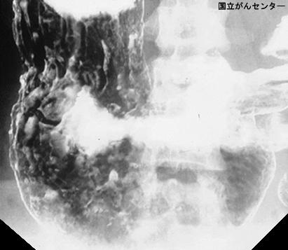 画像ID:4684