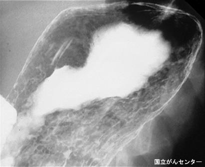 画像ID:4685