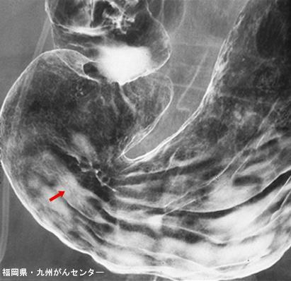 画像ID:4720