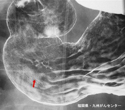 画像ID:4722