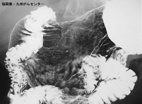 画像ID:4799