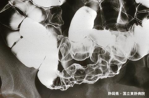 画像ID:4860
