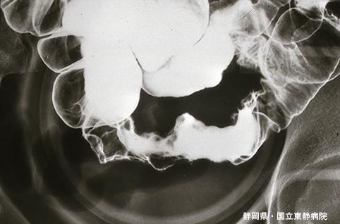 画像ID:4861