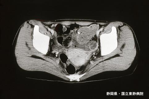 画像ID:4866