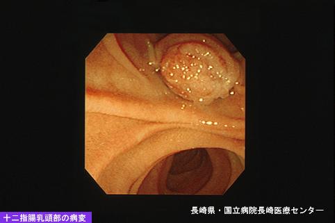 画像ID:4936