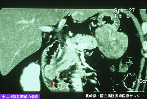 画像ID:4943