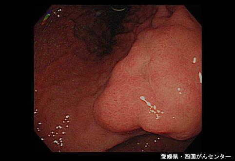画像ID:4968