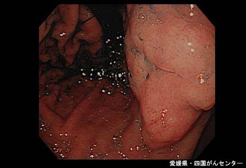 画像ID:4970