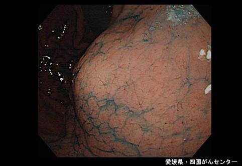 画像ID:4972
