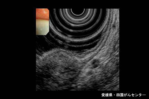 画像ID:4974